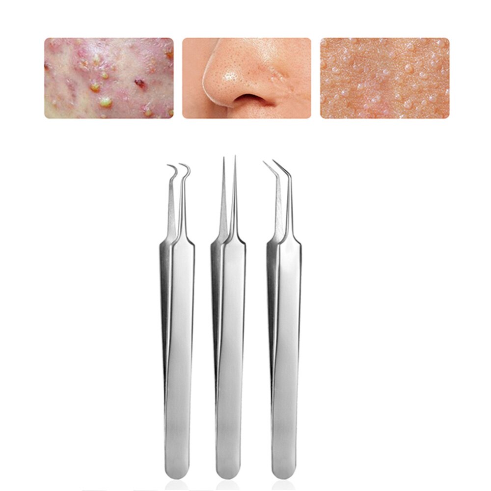 3 Pcs/lot Acne Needle Tweezers Blackhead Blemish Pimples Removal Pointed Bend Gib Head Face Care Tools Comedone Acne Extractor